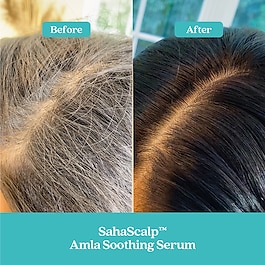 SahaScalp™ - Amla Soothing Scalp and Hair Serum